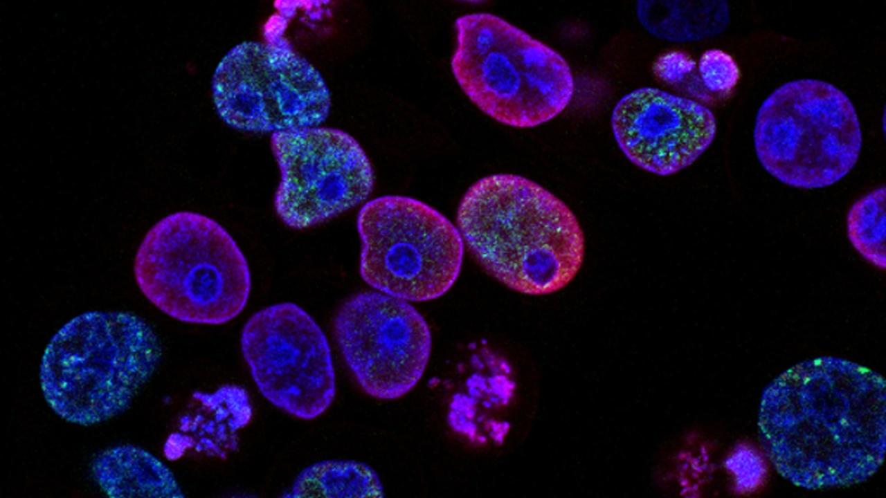 Cientistas testam vírus que destrói tumores malignos