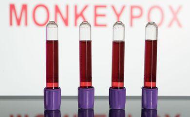 Primeiras vacinas contra varíola dos macacos devem chegar em setembro
