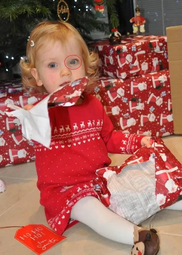 Após tirar foto com flash, mãe descobre câncer raro na filha de 1 ano